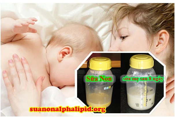 Sữa non là loại sữa đầu tiên tiết ra trong 3 – 5 ngày đầu sau khi sinh con